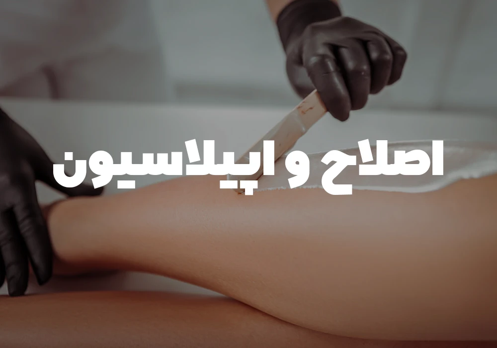 اصلاح و اپیلاسیون